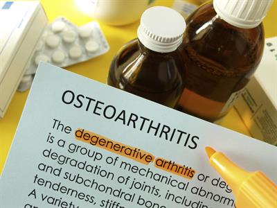 Pycnogenol for Osteoarthritis