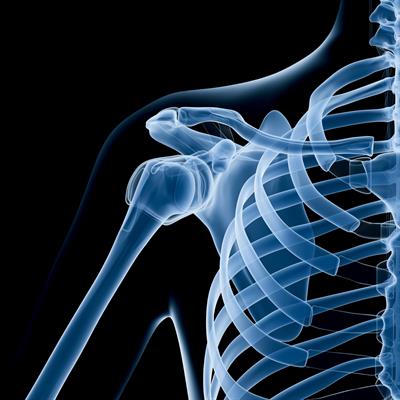 Glucosamine sulphate vs Glucosamine hydrochloride